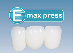 瑞士e.max press仿生美容修复